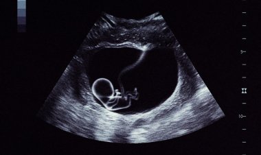 Vacra - En Attendant Paphos (Album complet)